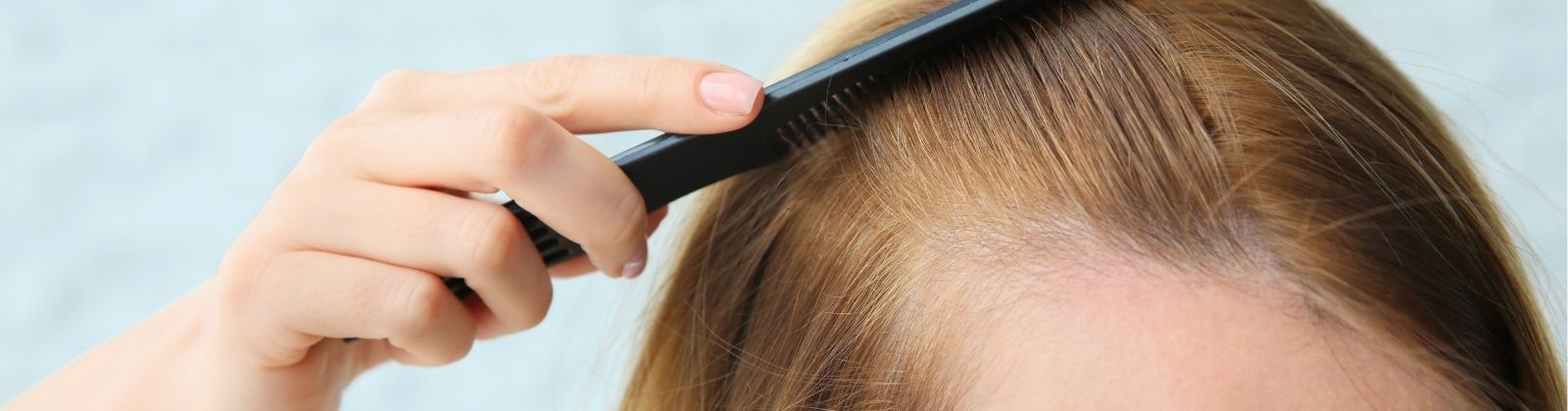 Scalp showing through the hair